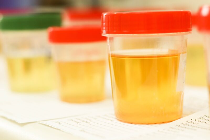 Do At Home Urine Alcohol Test