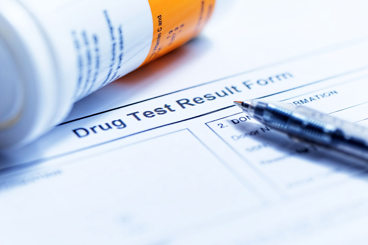 Department of Transportation Drug Test