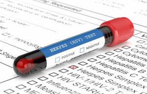 Herpes Screening